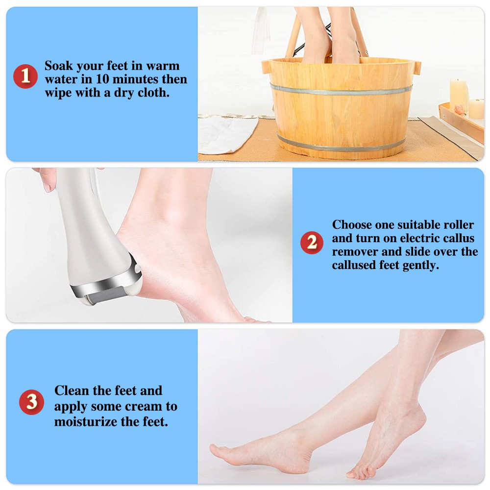 Máy tẩy tế bào chết TOGEWITHU điện/ tẩy vết chai chân chạy màu trắng/ đen với 3 đầu lăn