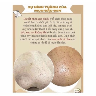 Thanh lăn mụn đầu đen mamo.de