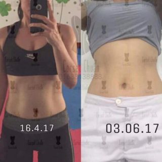 ĐAI SIẾT 4D CỦA CORSET CHUẨN
