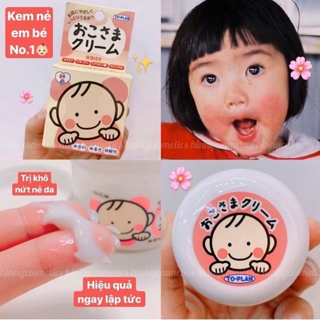 Kem dưỡng chàm nẻ cho bé Okosama To-plan Nhật Bản 30g