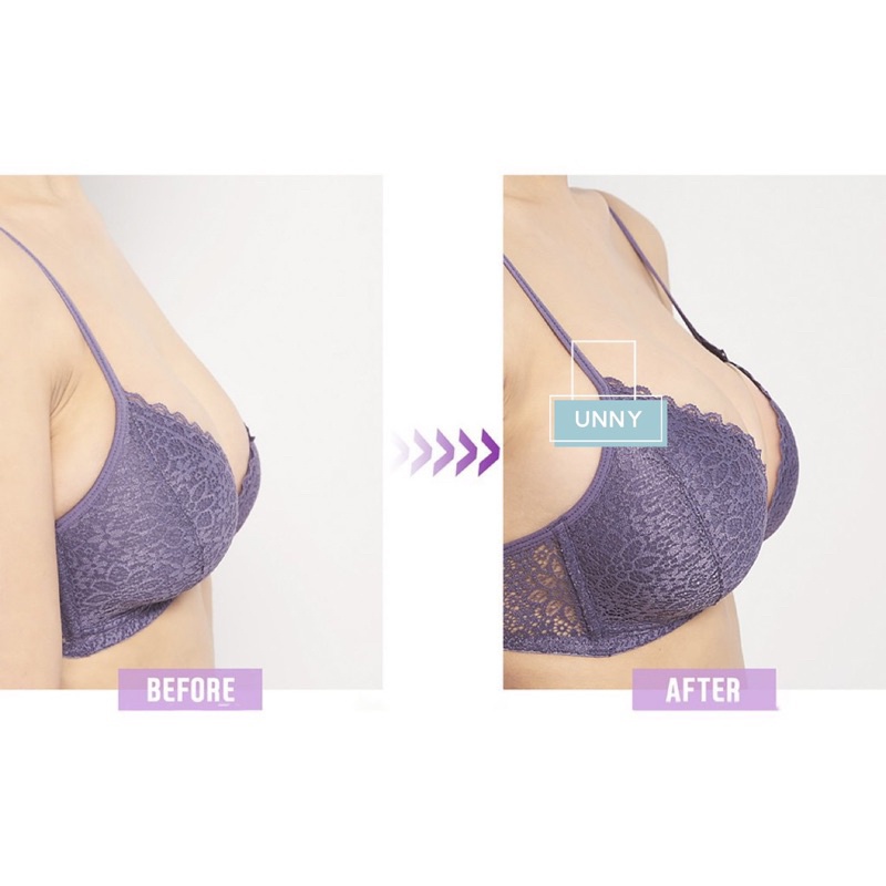 Áo Lót Dán Silicon Cài Trước Nâng Ngực Tạo Khe Ngực Chuyên Mặc Trang Phục Hở Lưng - Unny Kho Đồ Lót Nam Nữ