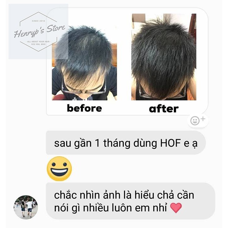 SIÊU DƯỠNG TÓC HAIR ON FLEEK | BigBuy360 - bigbuy360.vn