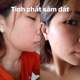 Tinh chất sâm đất