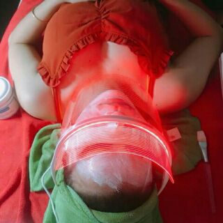 MẶT NẠ ÁNH SÁNG SINH HỌC