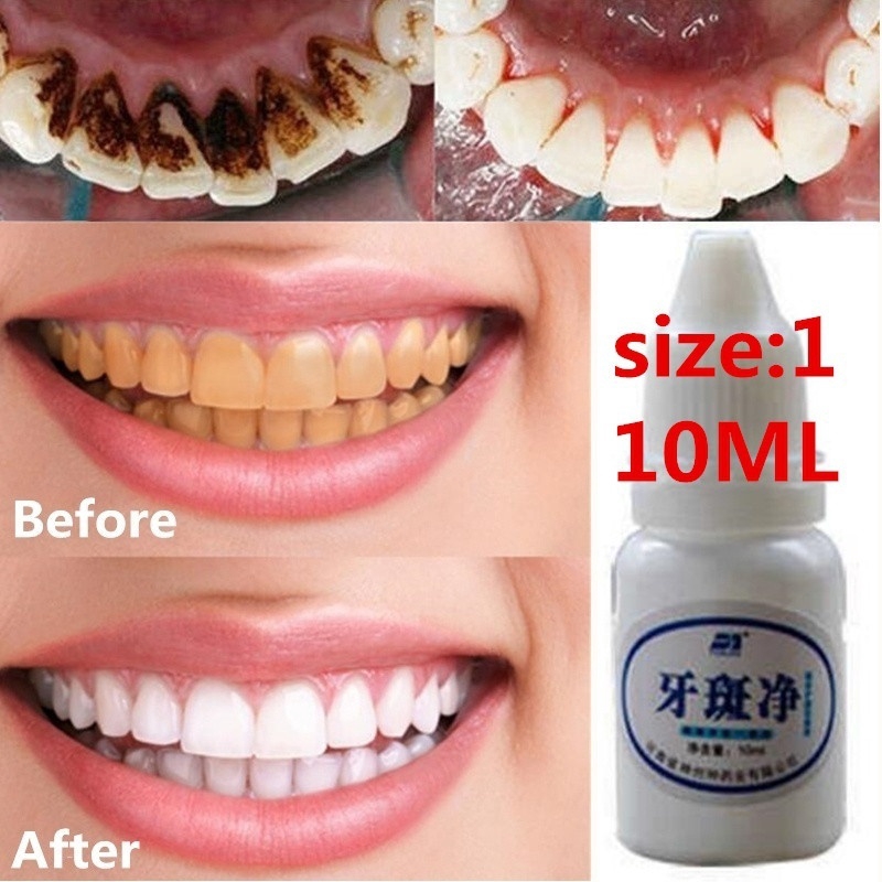 Bột Làm Trắng Răng Chất Lượng Cao