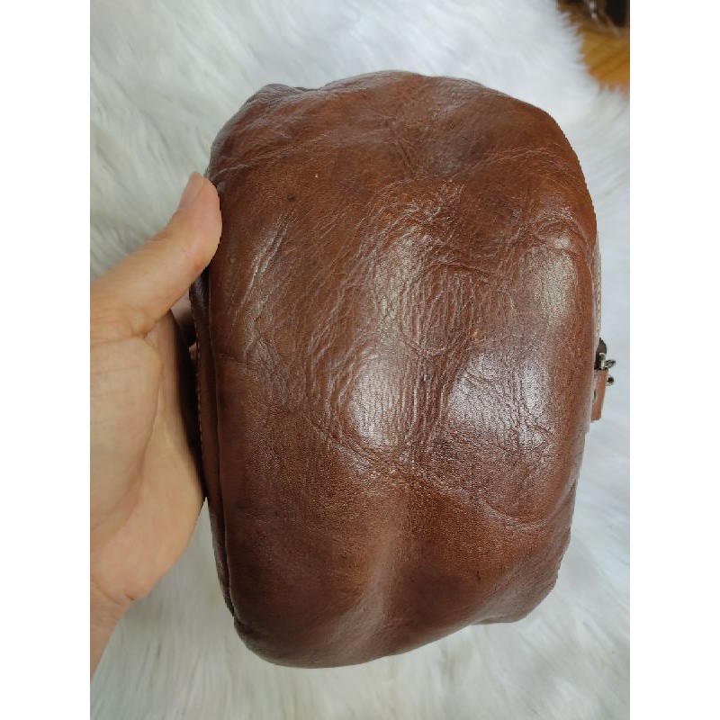 Bao tử da thật
