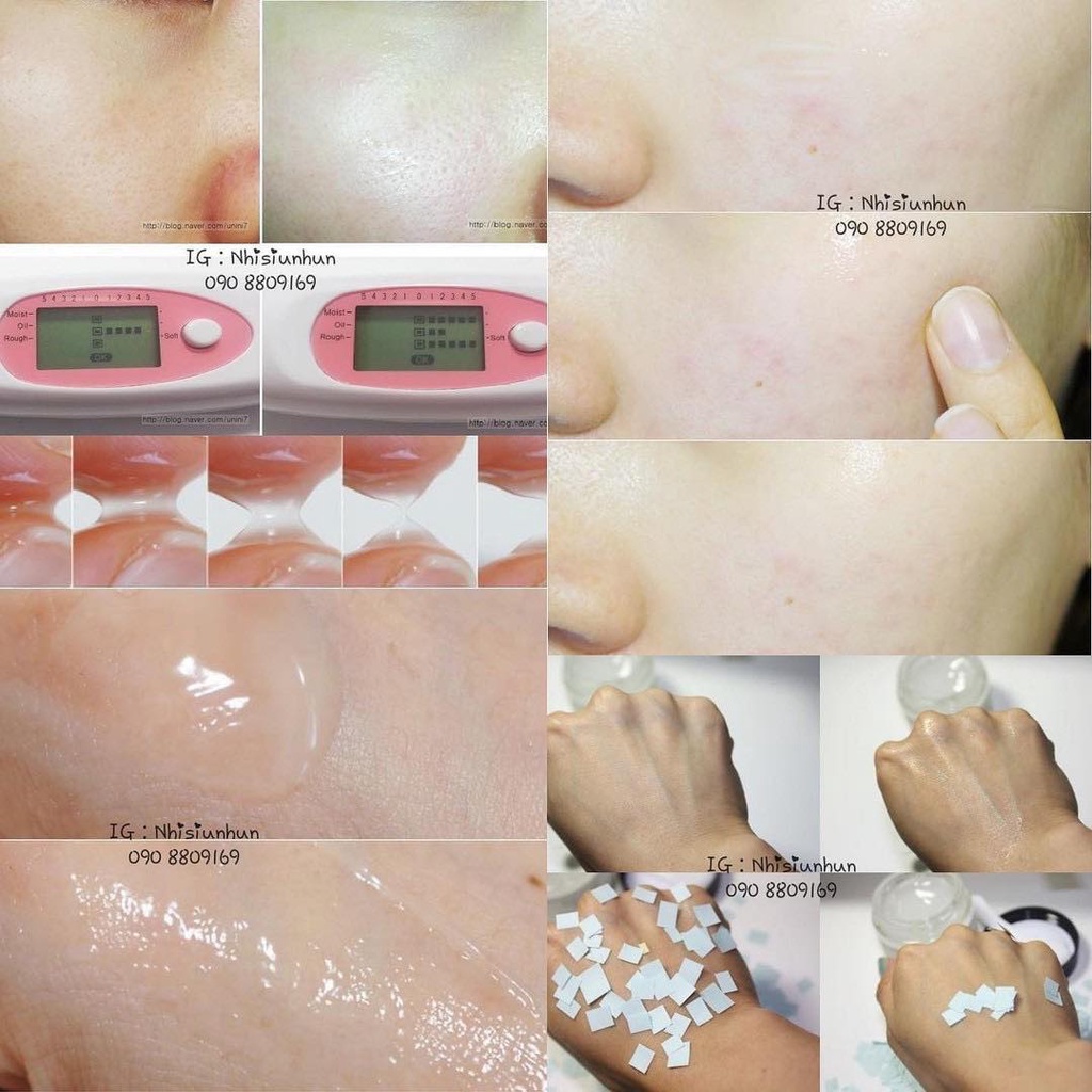 Kem dưỡng Vitamin Tree Water Gel