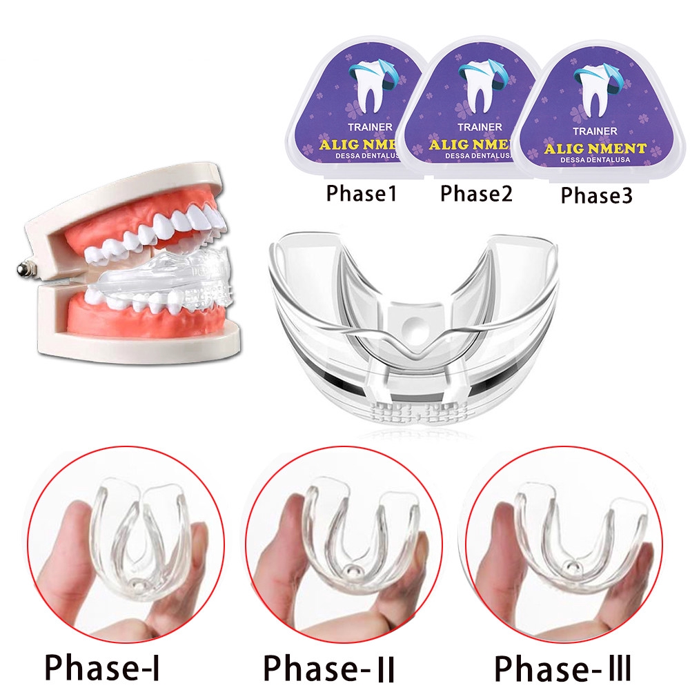 (Hàng Mới Về) Bộ 3 Miếng Niềng Răng Chỉnh Hình Răng Chuyên Dụng Cho Người Lớn