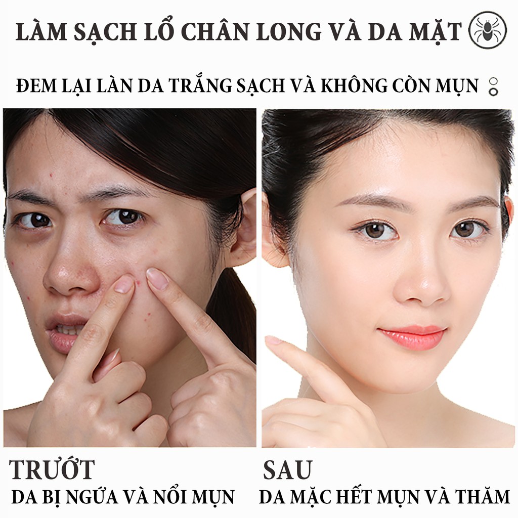 BỘ COMBO MẶT NẠ HOÀNG KIM + SỮA RỬA MẶT NGÀY ĐÊM CHĂM SÓC DA TIẾT KIỆM QX0032 QX0010