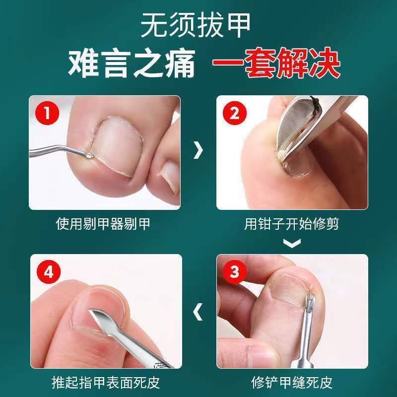 Z Bộ Kềm Cắt Móng Tay / Móng Chân Bằng Thép Không Gỉ