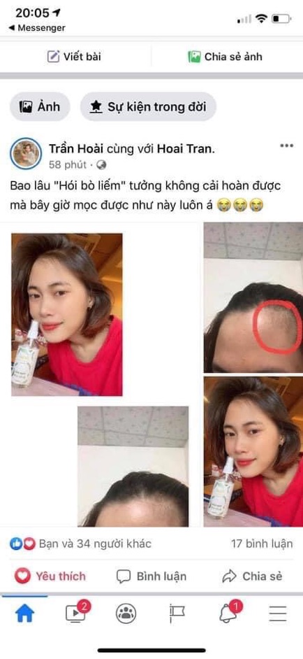 Xịt Tinh dầu bưởi non. Khắc tinh của hói, bò liếm, tóc mỏng | BigBuy360 - bigbuy360.vn