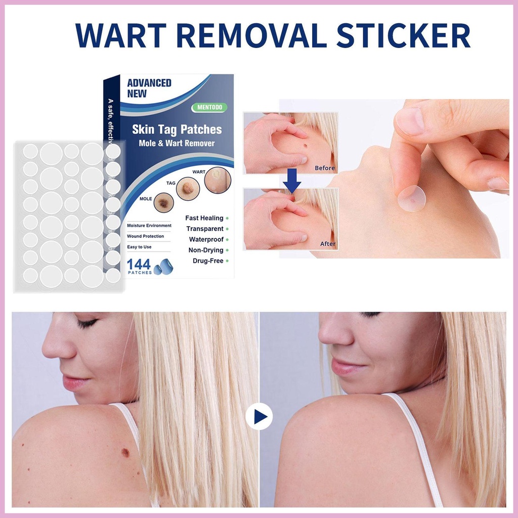 Gel Hydrocolloid Tẩy Mụn Thịt Dư Trên Mặt Và Cơ Thể An Toàn