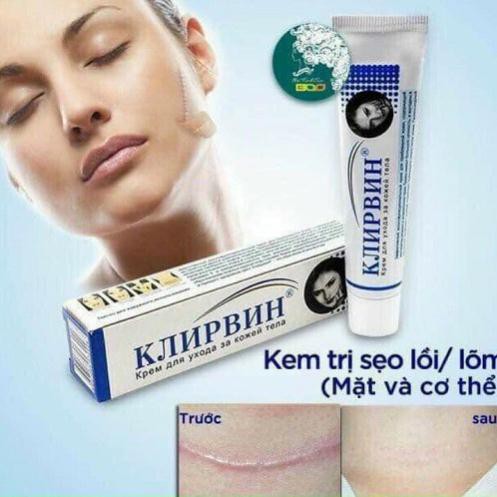 [CHÍNH HÃNG 100%] Kem mờ sẹo Nga - 25g - Mờ các loại sẹo, rỗ, thâm, nám hãy kiên trì sau 2 tháng để thấy hiệu quả