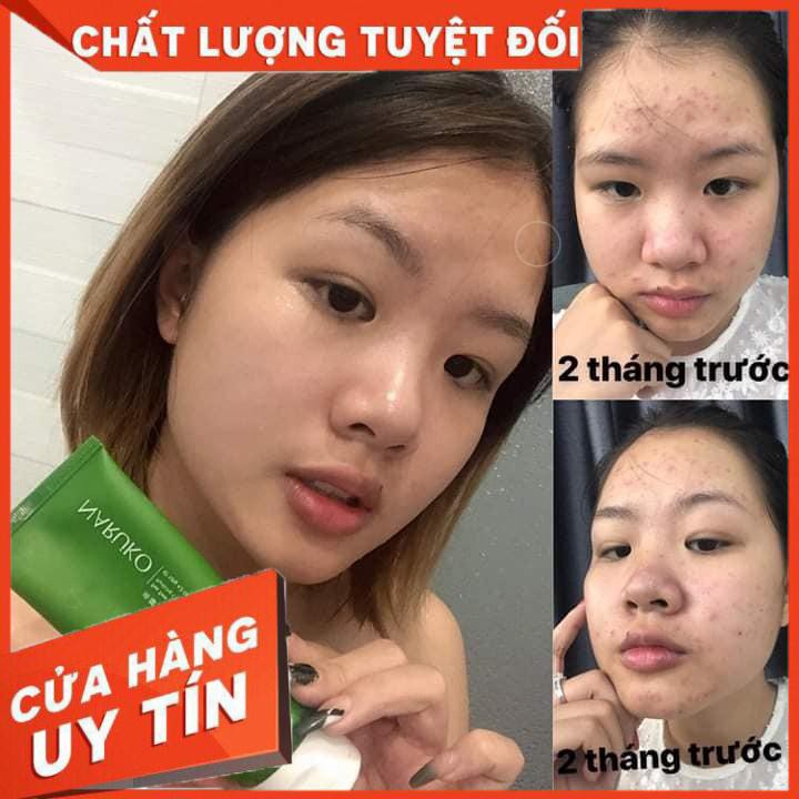 Sữa rửa mặt, sữa rửa mặt Naruko tràm trà, sữa rửa mặt phù hợp da dầu da mụn | BigBuy360 - bigbuy360.vn
