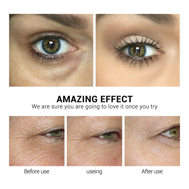 Mặt nạ mắt LANBENA chiết xuất retinol giảm quầng thâm bọng mắt nuôi dưỡng làm săn chắc da 90g | BigBuy360 - bigbuy360.vn