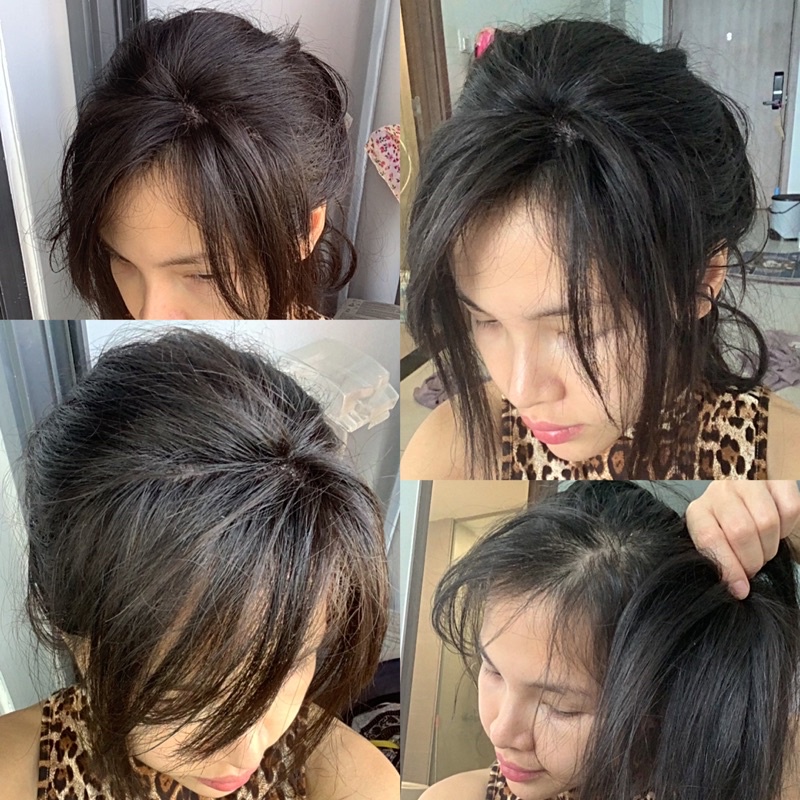 mái chéo = mái bằng = da đầu 3D (hình thật)
