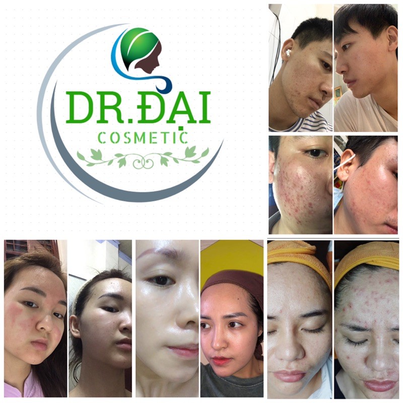 Biosystine - viên uống đẹp da chống lão hoá da | Thế Giới Skin Care