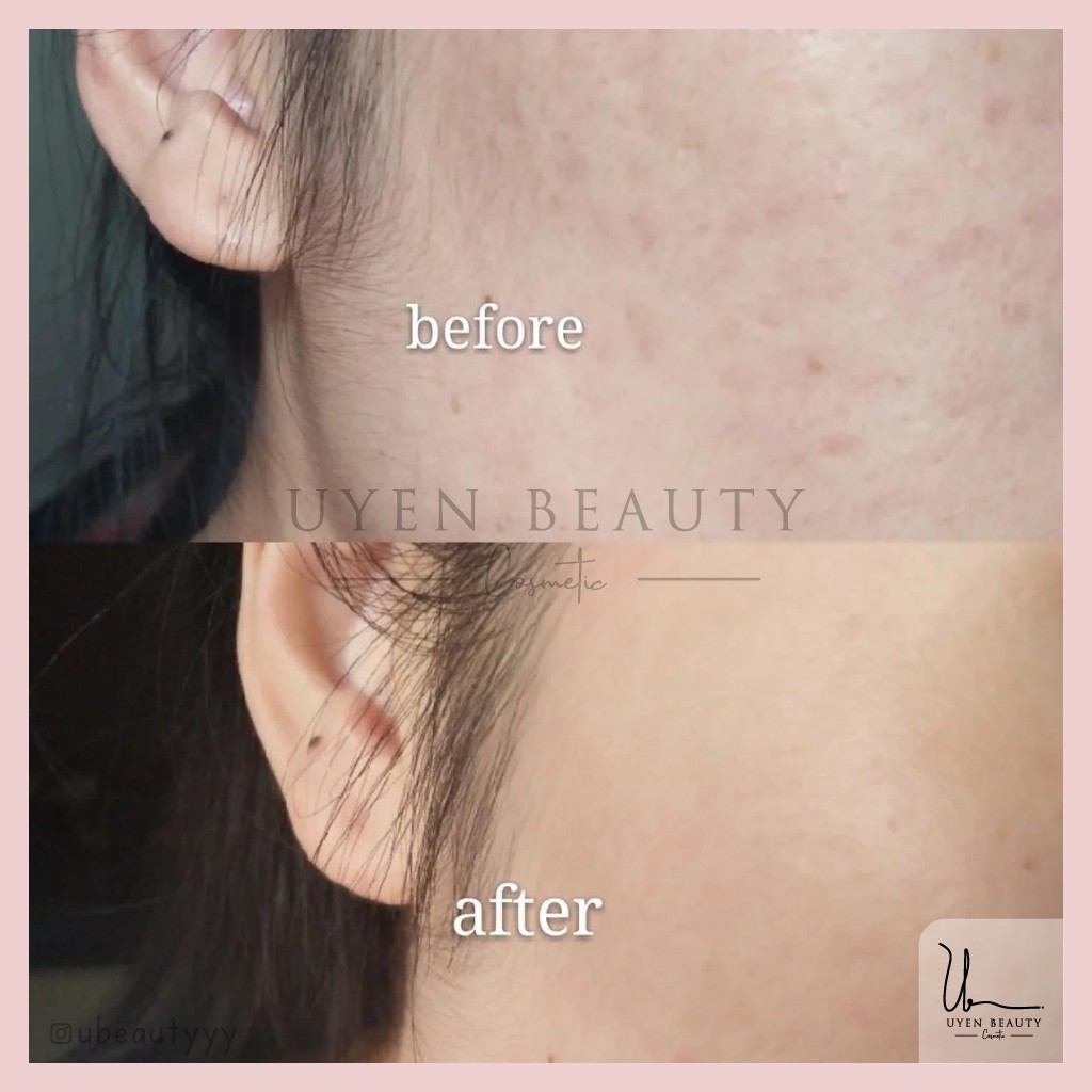 Tinh Chất Dưỡng Da Vitamin C Melano CC Beauty Essence 20ml