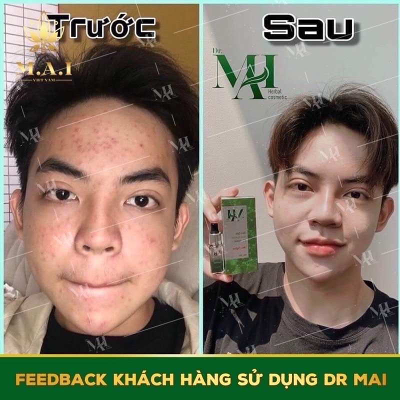 SERUM DR.MAI NGUYÊN CHẤT VÀ MIX SAFFARON