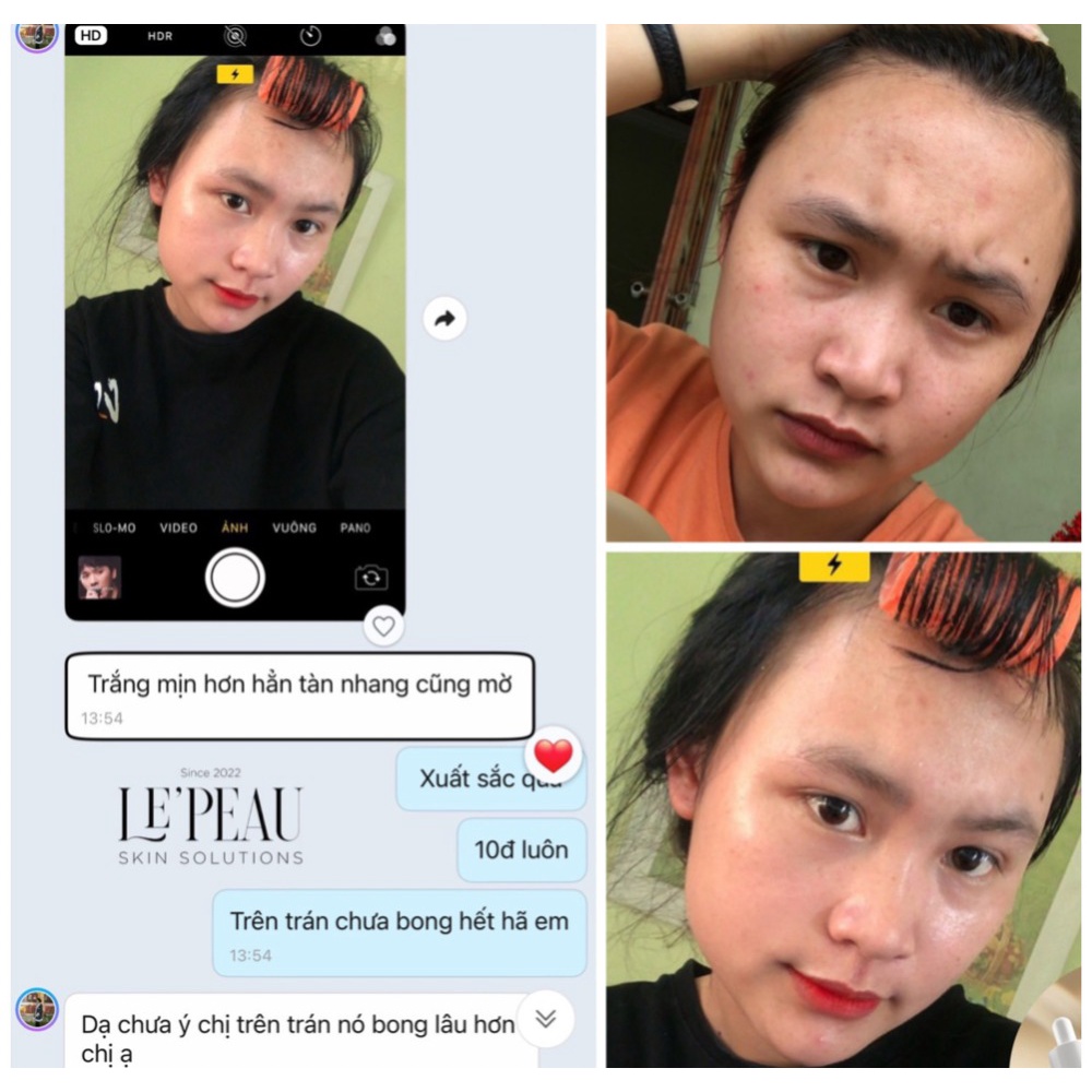 LE’PEAU - Peel da Vi Tảo Retinol chính hãng