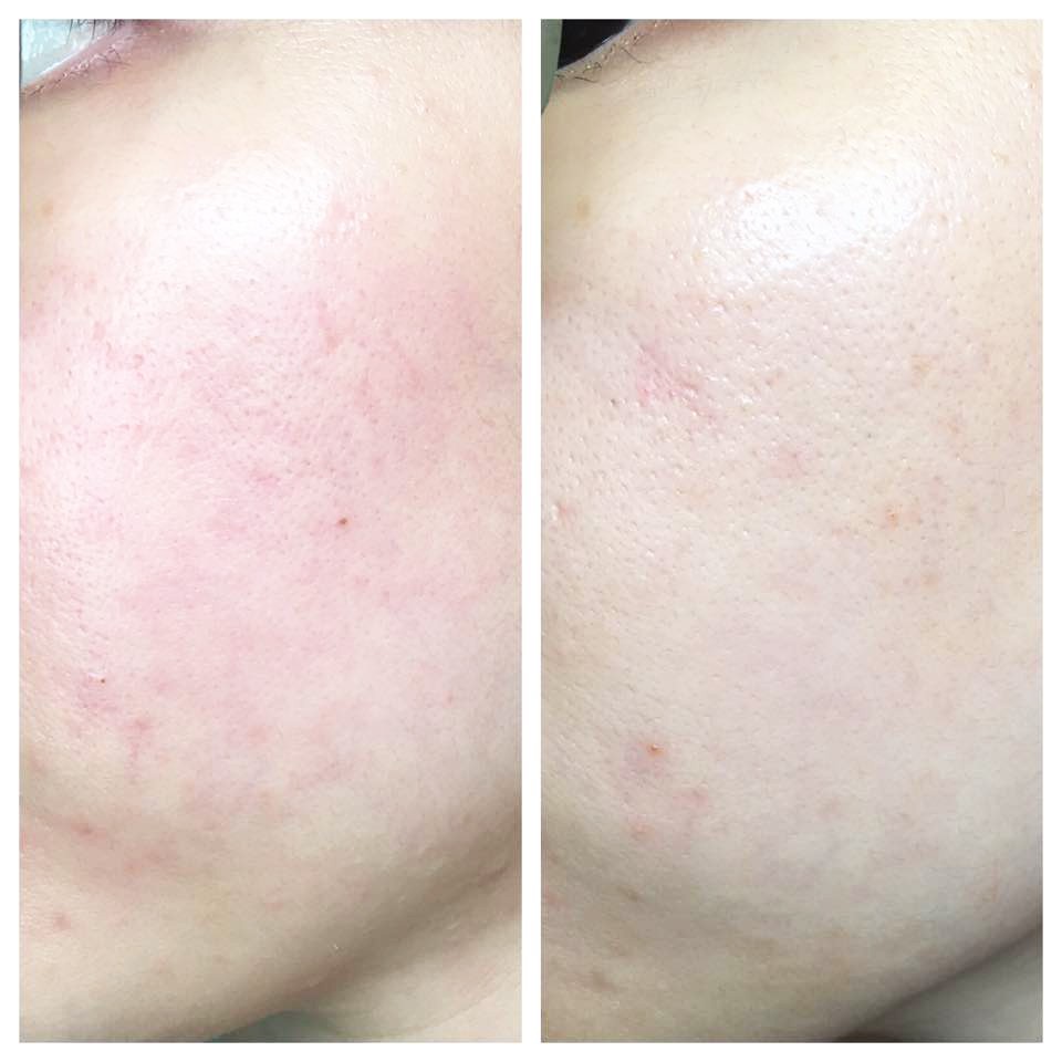 Tinh Chất Keo Ong Cấp Ẩm, Dưỡng Trắng, Ngừa Lão Hóa CNP Laboratory Propolis Energy Active, Vita-B Brightening Ampule