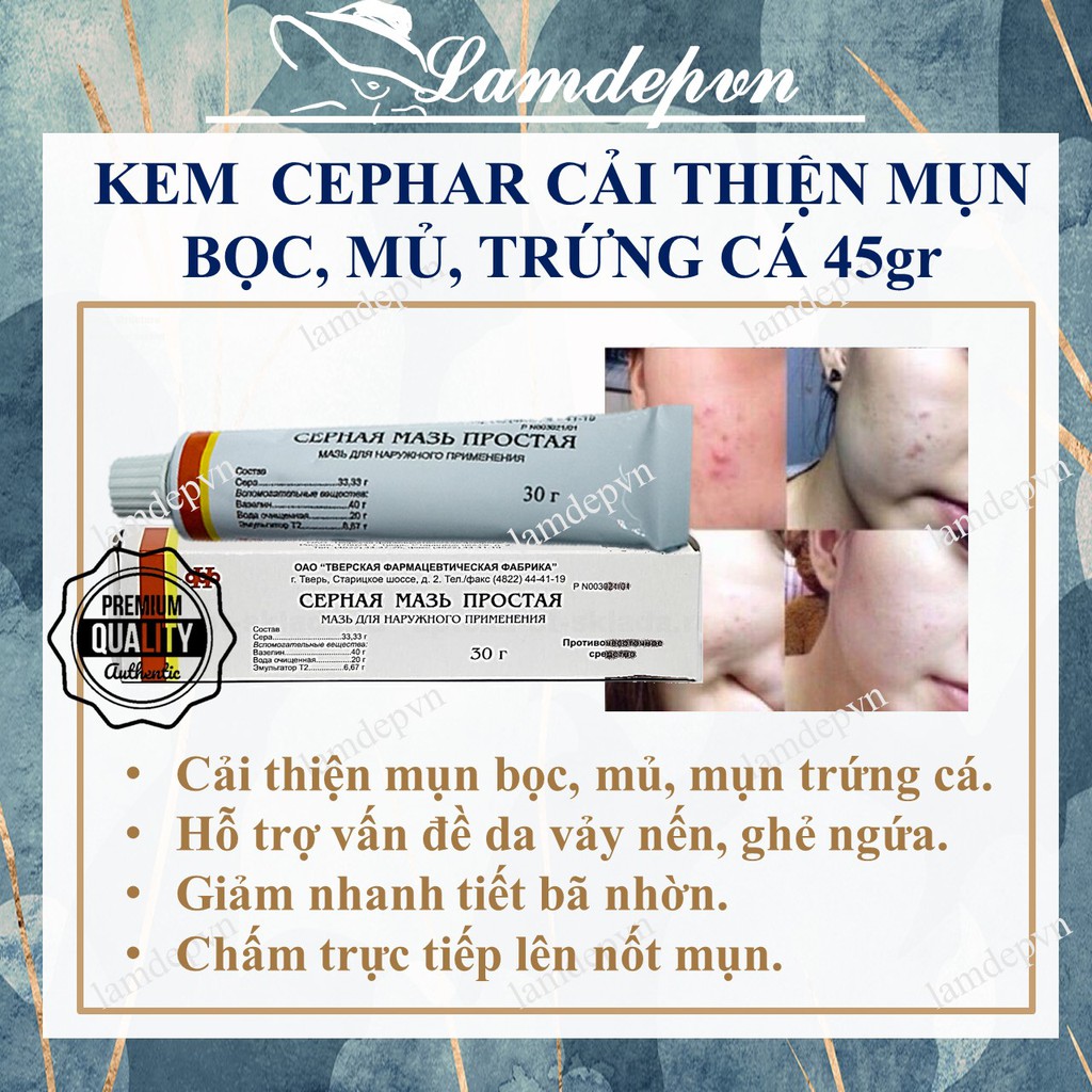 Kem Lưu huỳnh Cephar chấm mụn bọc, mủ,trứng cá Mỡ lưu huỳnh mụn Nga