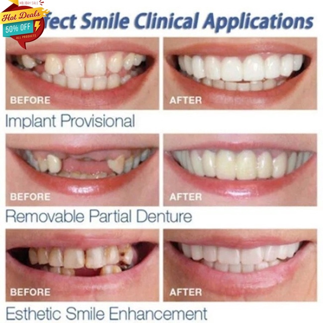 Bộ 2 bọc răng trắng có thể tái sử dụng