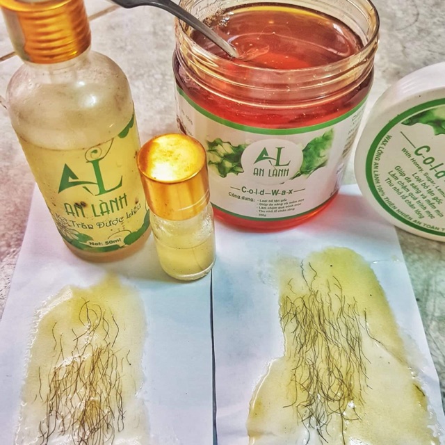 Triệt lông vĩnh viễn An Lành