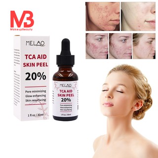 [Hàng mới về] Huyết thanh Melao acid dưỡng ẩm chống lão hóa và nếp nhăn 30ml