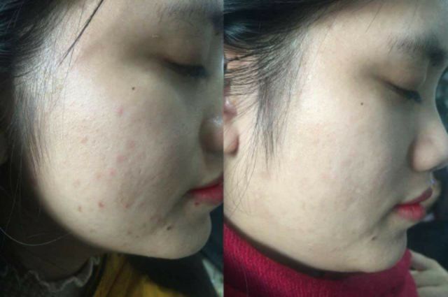 Serum phun oxy tươi Casmara Pháp