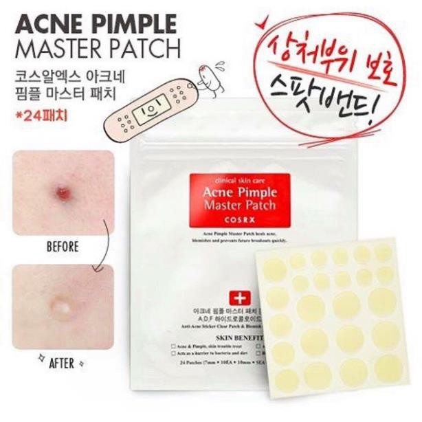 MIẾNG DÁN HÚT MỤN COSRX ACNE PIMPLE MASTER PATCH