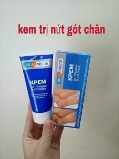 KEM TRỊ NỨT GÓT CHÂN NGA