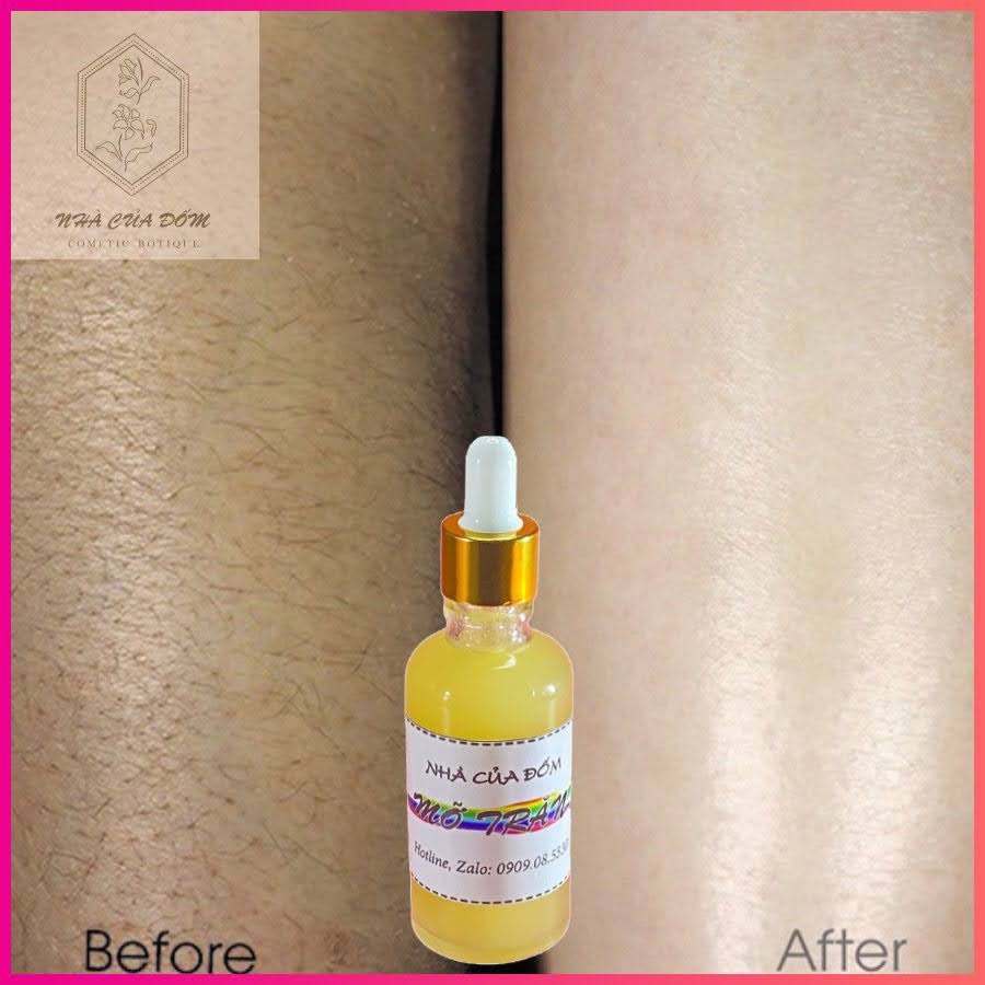 Combo triệt lông sáp wax nóng wax lông, nồi nấu sáp pro wax 100 và 50 ml mỡ trăn nguyên chất + Tặng 5 que lấy sáp