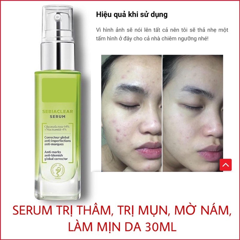 [Bill Pháp] Serum Sebiaclear Giúp Giảm Mụn, Giảm Thâm, Làm Mềm Mịn Da 30ml | BigBuy360 - bigbuy360.vn