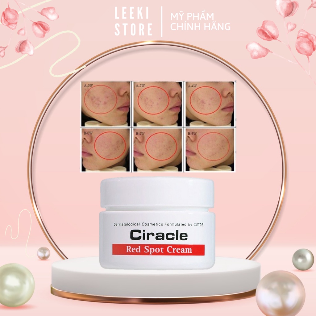 Kem giảm mụn Ciracle Red Spot Cream (30g)