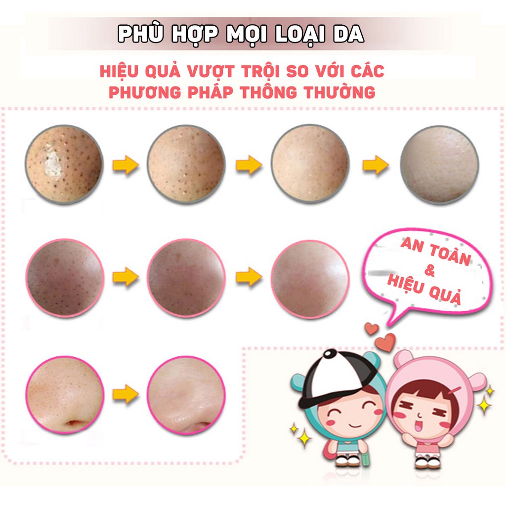Miếng lột mụn mũi 3 bước Bioaqua - Đẩy mụn - Lột mụn - Se nhỏ chân lông | BigBuy360 - bigbuy360.vn