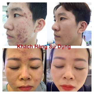 MẶT NẠ NGỌC SÂM [Dưỡng Da] ✔️