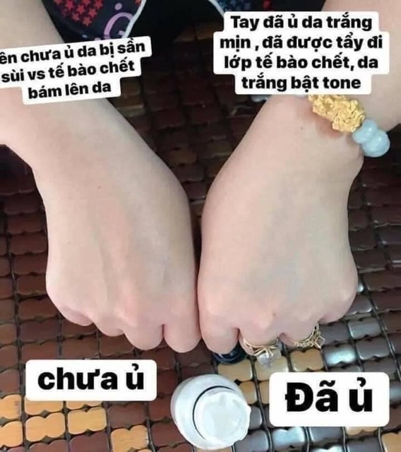 [HÀNG CHUẨN] Ủ SỮA NON KÍCH TRẮNG DƯỠNG ẨM DA