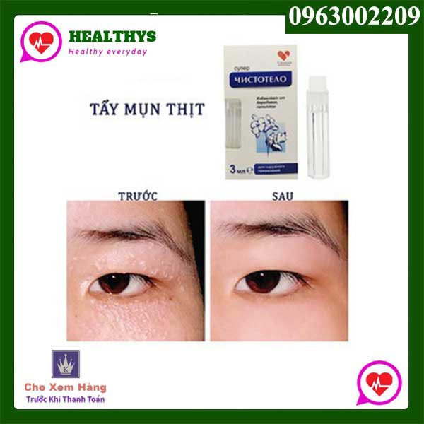 𝐓𝐡𝐮𝐨̂́𝐜 hỗ trợ 𝐭𝐫𝐢̣ nốt ruồi , mụn cóc , mụn cơm , mụn thịt (Chính Hãng) và kem hỗ trợ làm mờ seo nga