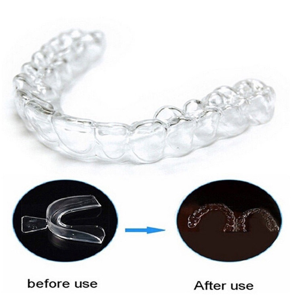 Set 2 khay ngậm làm trắng răng chất liệu silicone an toàn cấp thực phẩm tiện dụng