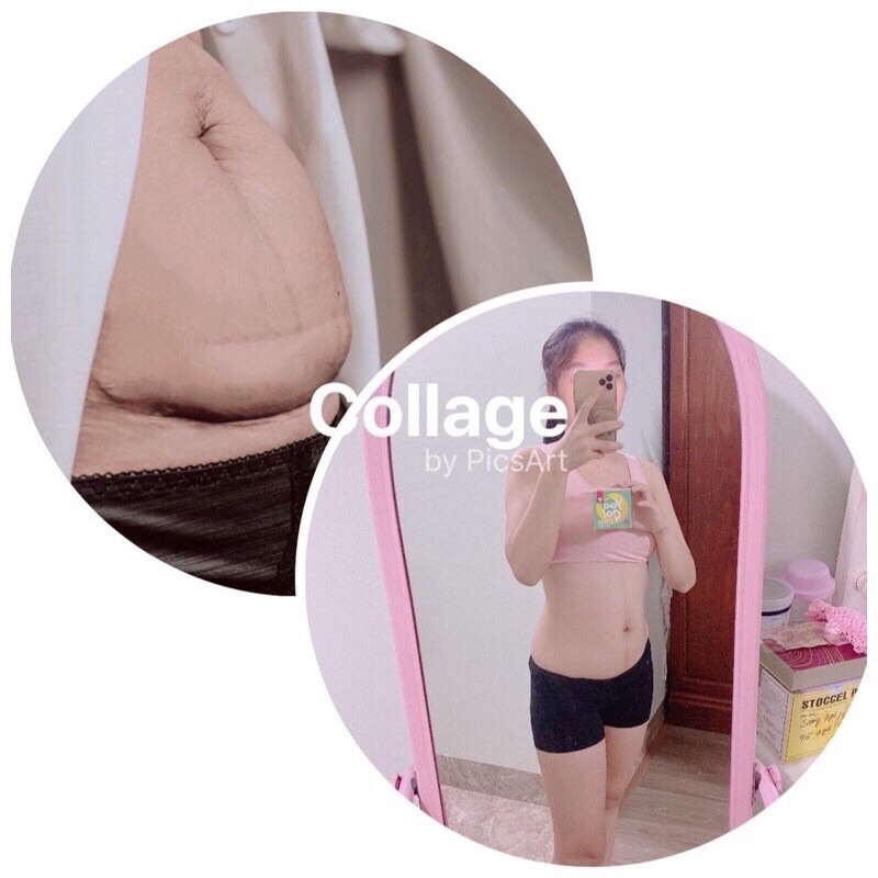 Trà T BODY HAIR SIBERI đào thải độc đốt mỡ thừa thanh lọc cơ thể hỗ trợ giảm cân | BigBuy360 - bigbuy360.vn