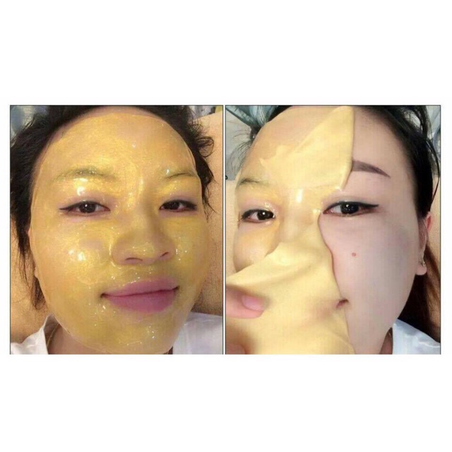 Mặt Nạ Collagen Tươi Vàng 24k Handmade Dưỡng Trắng Da, Mờ Thâm, Nám, Sạm Da - Thẩm Mỹ Huyền Trang NANOCEE