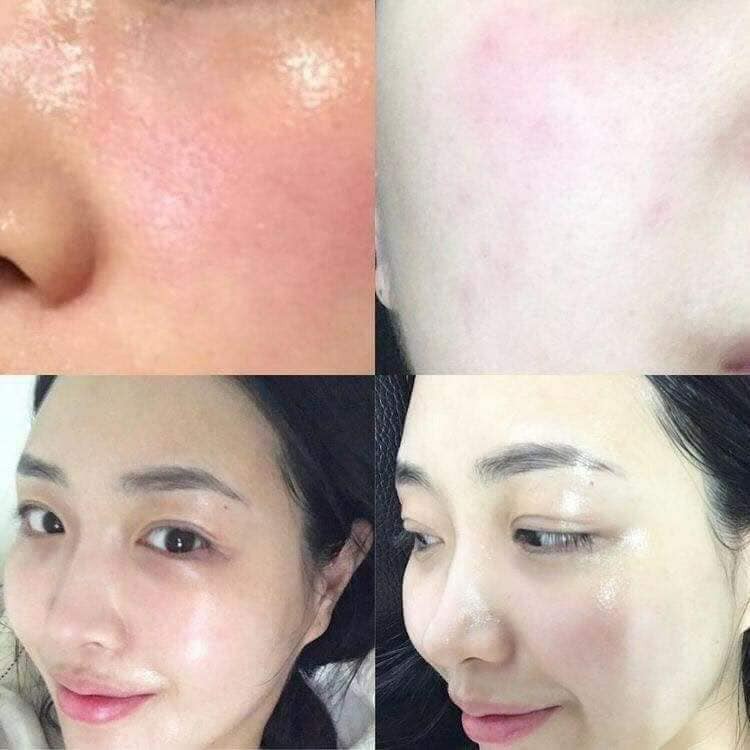 [Hàng mới có vòi] Toner siêu căng bóng Dr Peptit | BigBuy360 - bigbuy360.vn