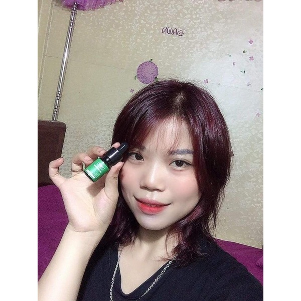 Serum mụn ( dr.skinacnes) | BigBuy360 - bigbuy360.vn