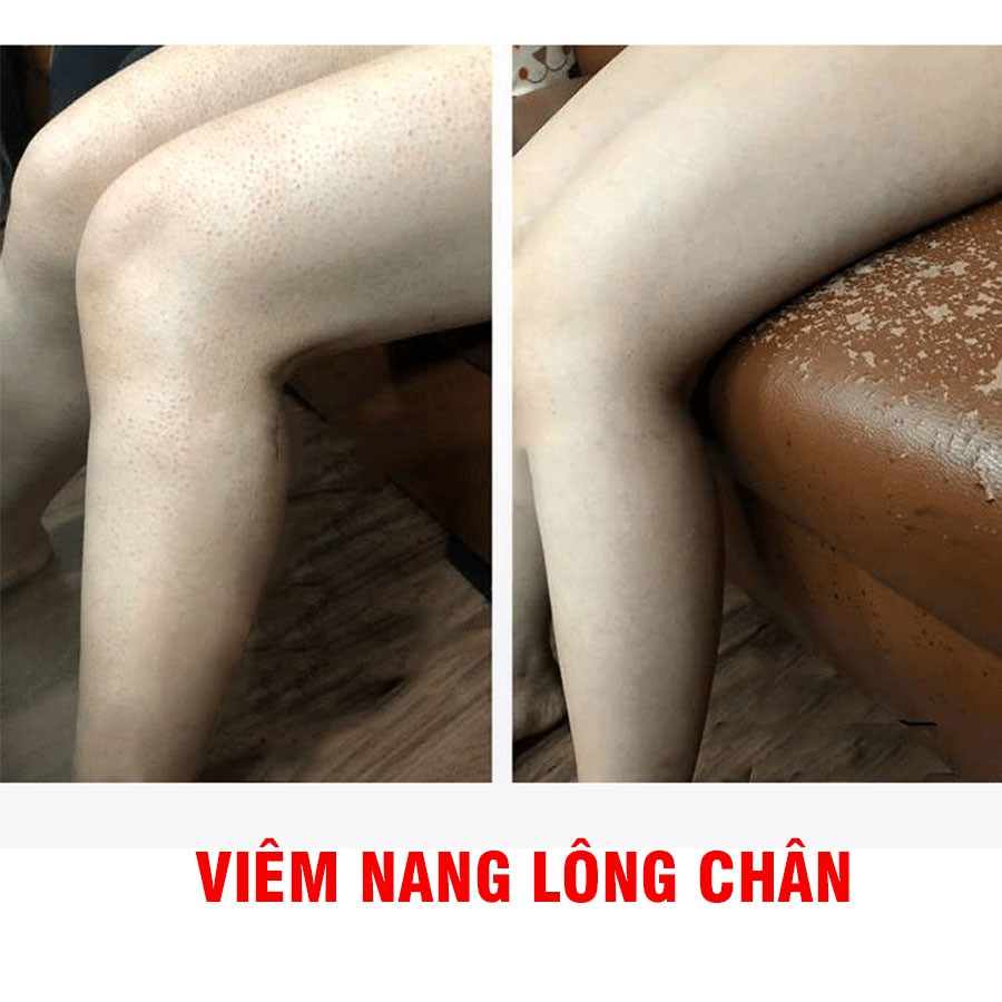 MUỐI TẮM TRỊ MỤN LƯNG, TẨY TẾ BÀO DA CHẾT BODY LASENTA - TINH CHẤT SỮA NON 200GR | Thế Giới Skin Care