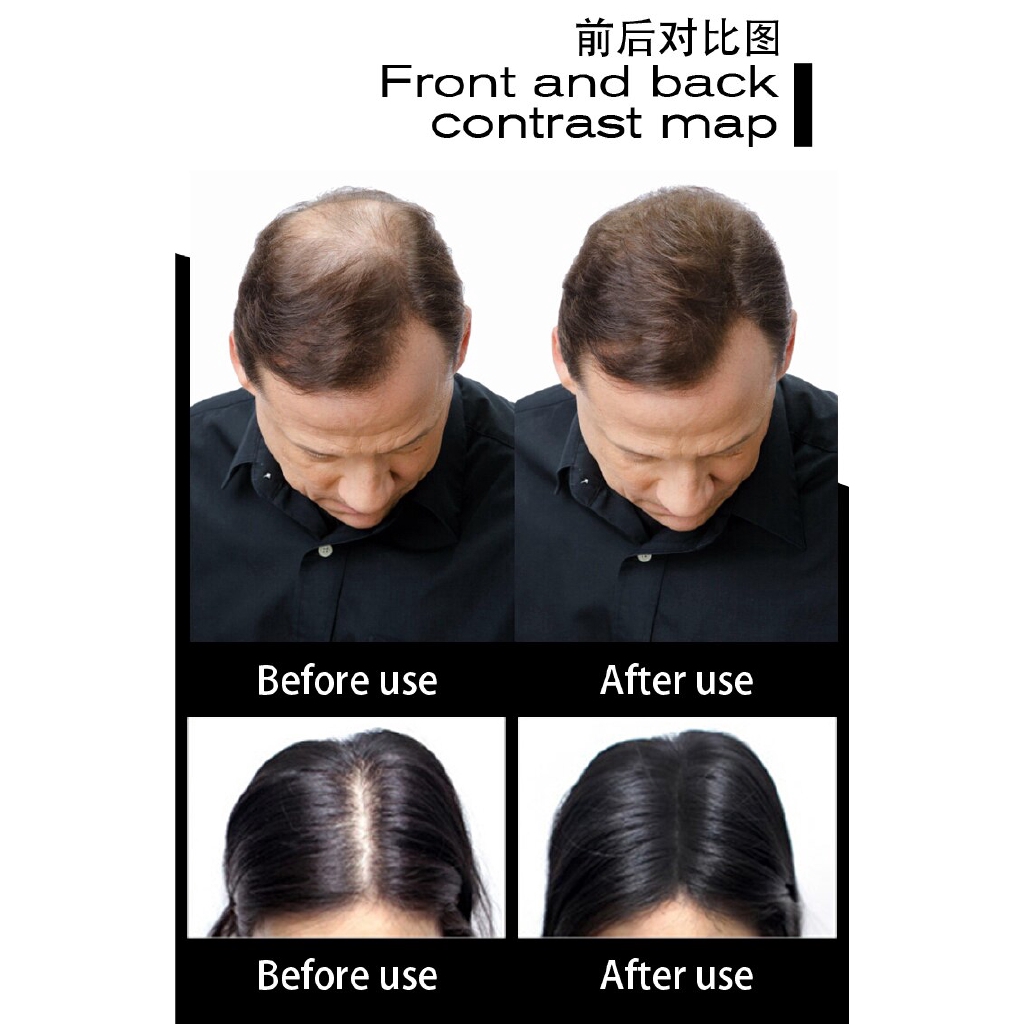 Lược chải tóc Keratin mát xa da đầu tiện dụng SEVICH