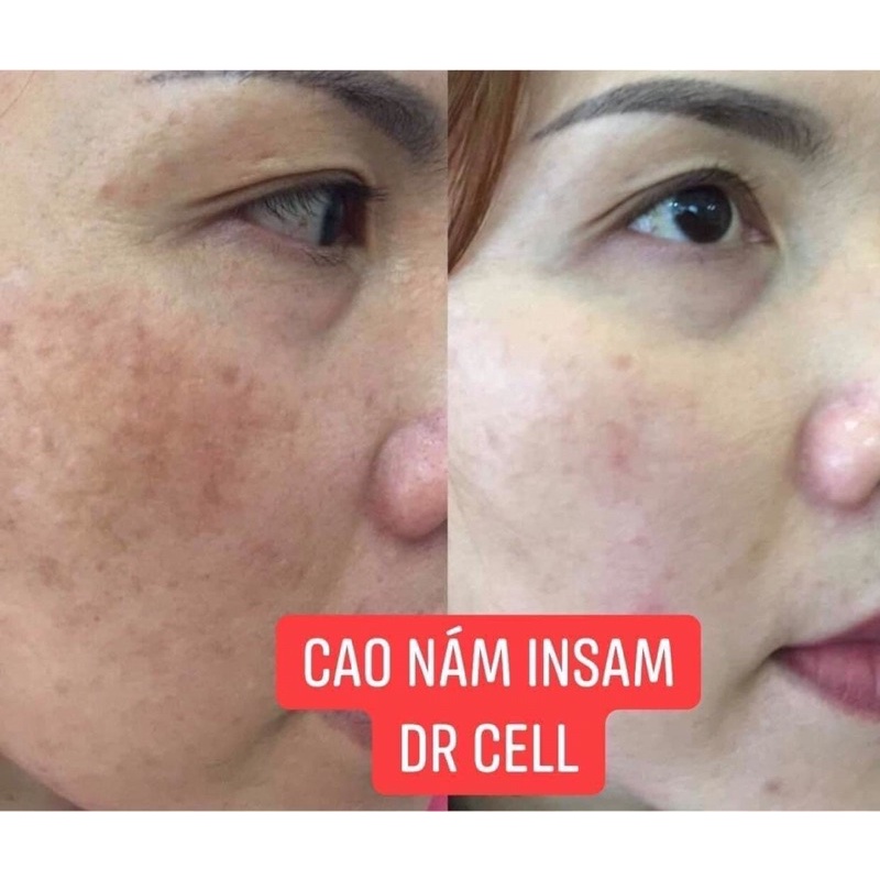 Cao Nám Insam Dr Cell 20g + Tặng Detox xổ mỡ Mộc Trà 10v