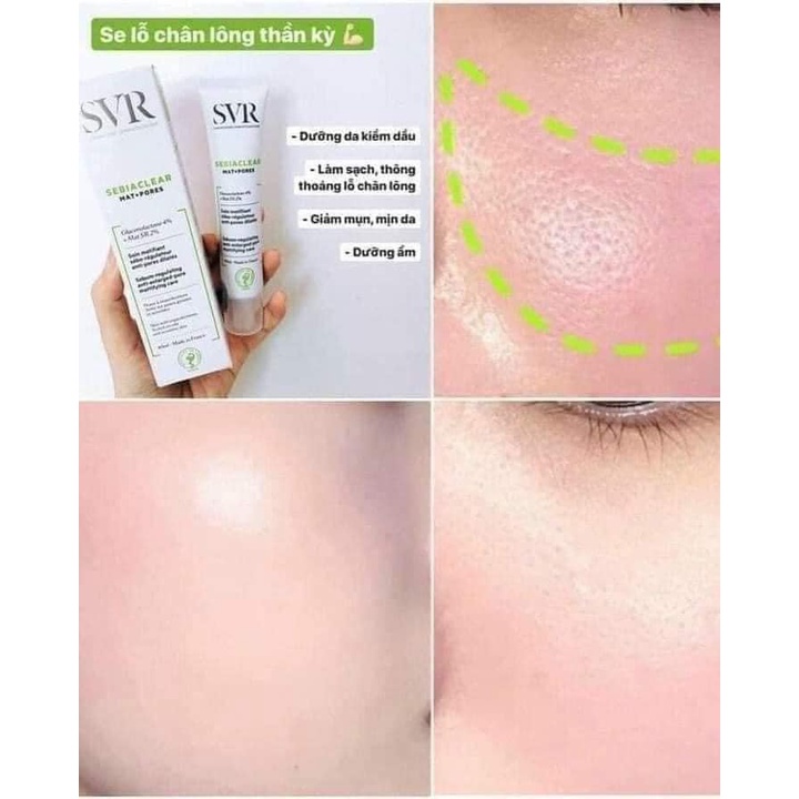 Kem Dưỡng SVR Kiềm Dầu Giảm Mụn Sưng Viêm Active Gel/ Sebiaclear Mat Pores/ Cicapeel