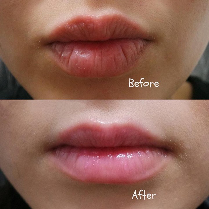 Tẩy tế bào chết môi Beauty Treats Lip Scrub