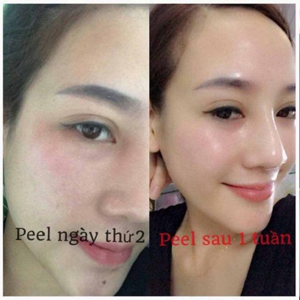 Peel da sinh học Dr.SkinPro